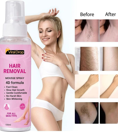 Hair Removal Mousse Spray – Smooth Skin in Minutes
